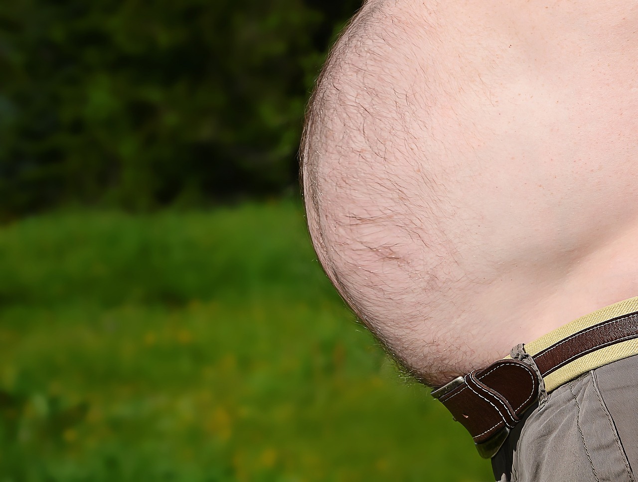 복부 성형